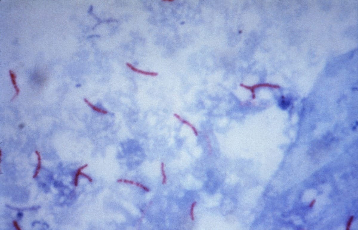 Microscope view: thin, slightly curved red rods scattered over a pale blue background