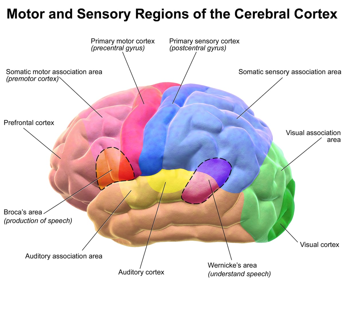 Side view of the outer brain in colours, with labelled areas: motor cortex, sensory cortex, Broca's area for speaking, Wernicke's area for understanding speech, auditory and visual cortex